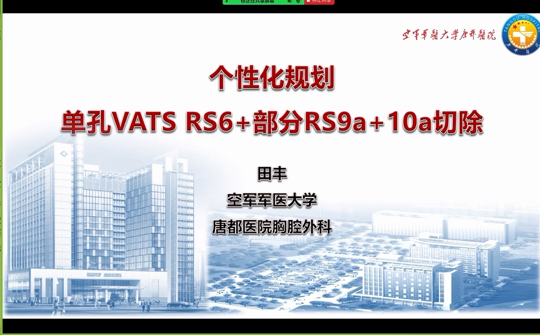 单孔胸腔镜RS6+部分RS9a+10a切除术 田丰-外科技术网